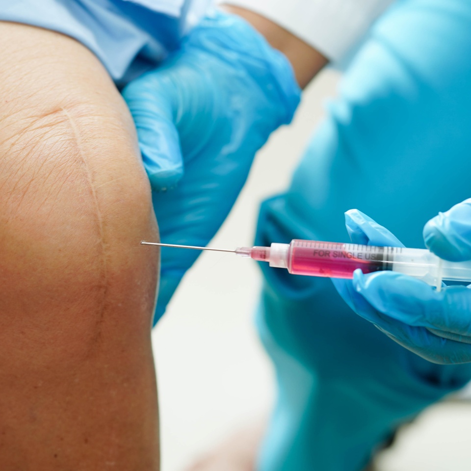 Asian doctor inject Hyaluronic acid platelet rich plasma into the knee of senior woman to walk without pain.