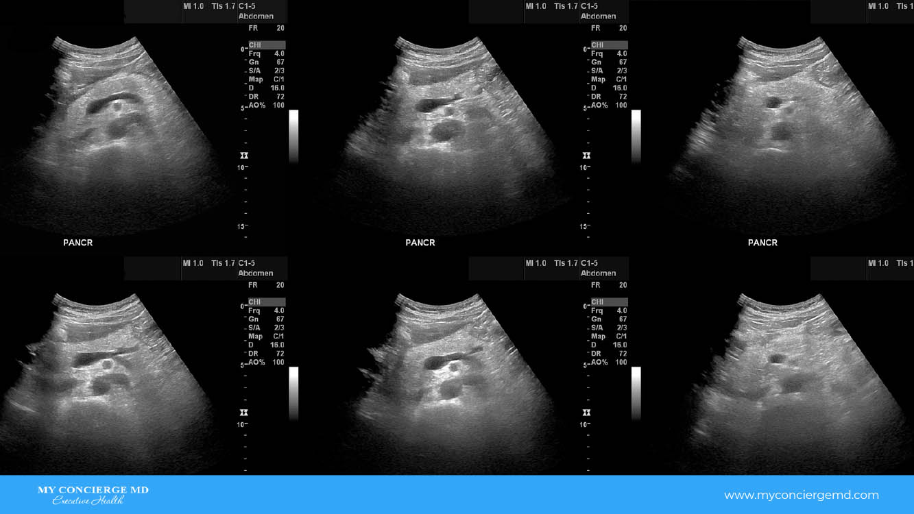 echogenic ultrasound